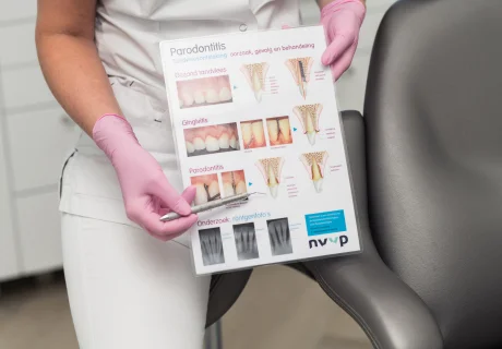 Roken en mondgezondheid